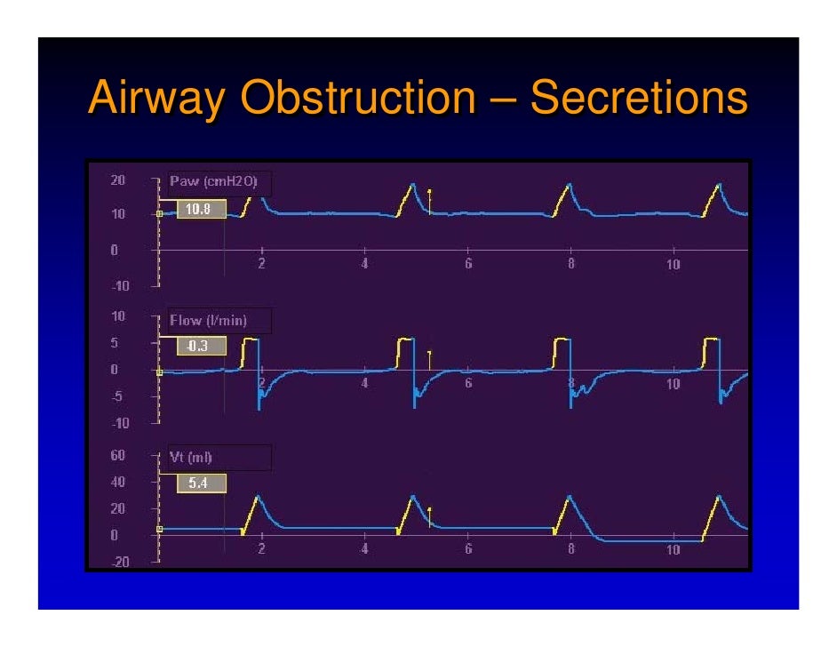 Respiratory Mechanics