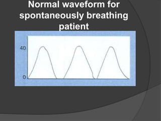 Normal O2 Waveform Respiratory Monitoring.pptx