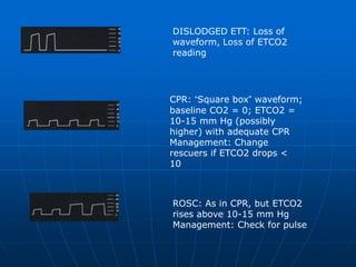 respiratory monitoring backup.ppt