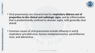 info@medicoseacademics.com
0310-7990649
Dr. Sidra Arshad, Asst. Prof. Physiology 19
• Viral pneumonias are characterized by respiratory distress out of
proportion to the clinical and radiologic signs, and by inflammation
that is predominantly confined to alveolar septa, with generally clear
alveoli
• Common causes of viral pneumonia include influenza A and B,
respiratory syncytial virus, human metapneumovirus, parainfluenza
virus, and adenovirus.
 
