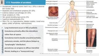 info@medicoseacademics.com
0310-7990649
Dr. Sidra Arshad, Asst. Prof. Physiology 28
• Lung involvement occurs in 90% of patients
• Granulomas primarily affect the interstitium
rather than air spaces
• Granulomas tend to localize around bronchioles,
pulmonary venules, and the pleura (known as
"lymphangitic" distribution)
• granulomas can progress to diffuse interstitial
fibrosis, leading to a "honeycomb lung”
 