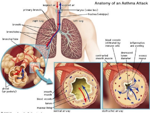 Terbutaline Injection To Stop Contractions