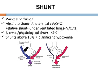 SHUNT
 Wasted perfusion
 Absolute shunt- Anatomical : V/Q=O
Relative shunt- under ventilated lungs- V/Q<1
 Normal/physiological shunt- <5%
 Shunts above 15% Significant hypoxemia
 