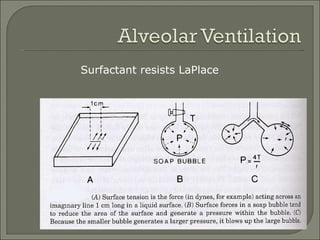Surfactant resists LaPlace 