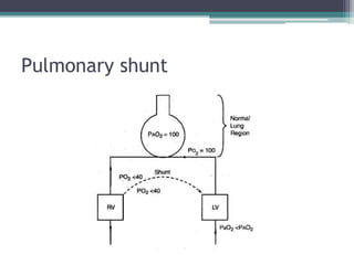 Pulmonary shunt
 