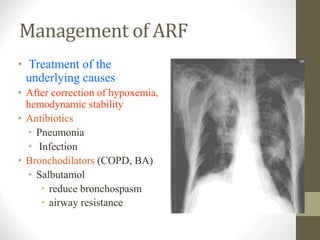 Respiratory Physiology.ppt