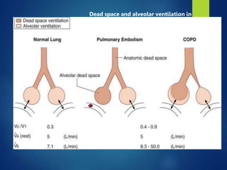 29
Dead space and alveolar ventilation in
normal and diseased lungs.
 