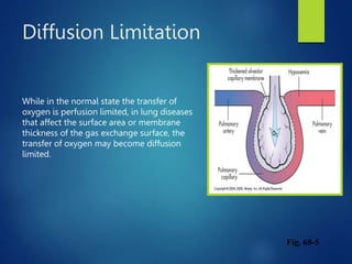 Diffusion Limitation
Fig. 68-5
While in the normal state the transfer of
oxygen is perfusion limited, in lung diseases
that affect the surface area or membrane
thickness of the gas exchange surface, the
transfer of oxygen may become diffusion
limited.
 