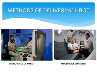 METHODS OF DELIVERING HBOT
MONOPLACE CHAMBER MULTIPLACE CHAMBER
 