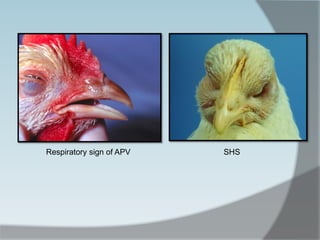 Respiratory sign of APV SHS
 