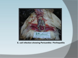 E. coli infection showing Pericarditis / Perihepatitis
 