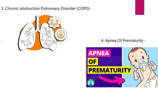 3. Chronic obstruction Pulmonary Disorder (COPD)-
. 4. Apnea Of Prematurity-
 