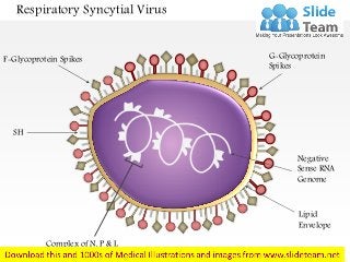 Respiratory Syncytial Virus
G-Glycoprotein
Spikes
F-Glycoprotein Spikes
Negative
Sense RNA
Genome
Lipid
Envelope
Complex of N, P & L
Proteins
SH
 