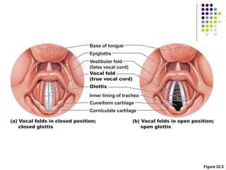 Figure 22.5
(a) Vocal folds in closed position;
closed glottis
(b) Vocal folds in open position;
open glottis
Base of tongue
Epiglottis
Vestibular fold
(false vocal cord)
Vocal fold
(true vocal cord)
Glottis
Inner lining of trachea
Cuneiform cartilage
Corniculate cartilage
 
