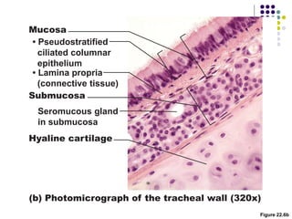 Figure 22.6b
(b) Photomicrograph of the tracheal wall (320x)
Hyaline cartilage
• Lamina propria
(connective tissue)
Submucosa
Mucosa
Seromucous gland
in submucosa
• Pseudostratified
ciliated columnar
epithelium
 