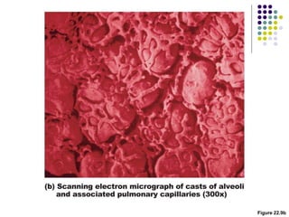 Figure 22.9b
 