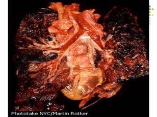 Respiratory_System-10.ppt