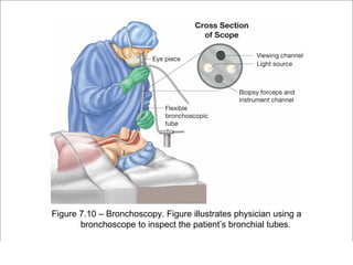 Figure 7.10 – Bronchoscopy. Figure illustrates physician using a
              bronchoscope to inspect the patient’s bronchial tubes.

                                                         Copyright ©2009 by Pearson Education, Inc.
Medical Terminology: A Living Language, Fourth Edition       Upper Saddle River, New Jersey 07458
Bonnie F. Fremgen and Suzanne S. Frucht                                          All rights reserved.
 