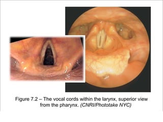Figure 7.2 – The vocal cords within the larynx, superior view
           from the pharynx. (CNRI/Phototake NYC)
                                                         Copyright ©2009 by Pearson Education, Inc.
Medical Terminology: A Living Language, Fourth Edition       Upper Saddle River, New Jersey 07458
Bonnie F. Fremgen and Suzanne S. Frucht                                          All rights reserved.
 