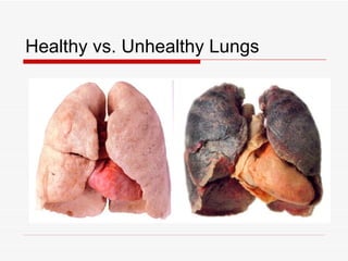 Healthy vs. Unhealthy Lungs
 