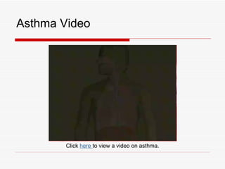Asthma Video




        Click here to view a video on asthma.
 