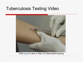 Tuberculosis Testing Video




      Click here to view a video on tuberculosis testing.
 