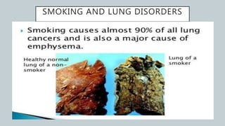 SMOKING AND LUNG DISORDERS
 