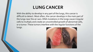 LUNG CANCER
With the ability to develop in any part of the lungs, this cancer is
difficult to detect. Most often, the cancer develops in the main part of
the lungs near the air sacs. DNA mutations in the lungs cause irregular
cells to multiply and create an uncontrolled growth of abnormal cells,
or a tumor.These tumors interfere with the regular functions of the
lungs.
 