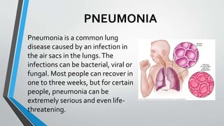 PNEUMONIA
Pneumonia is a common lung
disease caused by an infection in
the air sacs in the lungs.The
infections can be bacterial, viral or
fungal. Most people can recover in
one to three weeks, but for certain
people, pneumonia can be
extremely serious and even life-
threatening.
 