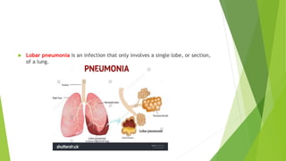  Lobar pneumonia is an infection that only involves a single lobe, or section,
of a lung.
 