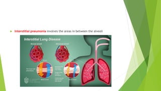  Interstitial pneumonia involves the areas in between the alveoli
 