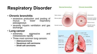 Respiratory Disorder
• Chronic bronchitis
• excessive production and pooling of
mucus in lower respiratory
passageways
• severely impairs ventilation and gas
exchange
• Lung cancer
• extremely aggressive and
metastasizes rapidly
• Three most common lung cancers:
• Adenocarcinoma
• Squamous cell carcinoma
• Small cell carcinoma
 