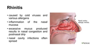Rhinitis
• caused by cold viruses and
various allergens
• inflammation of the nasal
mucosa
• excessive mucus produced
results in nasal congestion and
postnasal drip
• nasal cavity infections often
spread
 