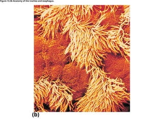 (b)
Figure 13.3b Anatomy of the trachea and esophagus.
 