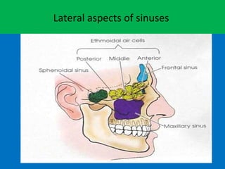 Lateral aspects of sinuses
 