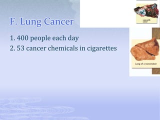F. Lung Cancer
1. 400 people each day
2. 53 cancer chemicals in cigarettes
 