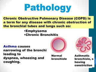 Chronic Obstructive
 Pulmonary Disease
Chronic Obstructive Pulmonary Disease (COPD) is
a term for any disease with chronic obstruction of
the bronchial tubes and lungs such as:
           •Emphysema
           •Chronic Bronchitis


Asthma causes
narrowing of the bronchi
leading to                 Normal       Asthmatic
dyspnea, wheezing and      bronchiole   bronchiole, s
coughing.                               howing     29
                                        constriction
 