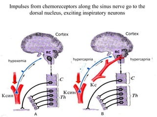 Impulses from chemoreceptors along the sinus nerve go to the
dorsal nucleus, exciting inspiratory neurons
hypoxemia hypercapnia hypercapnia
RC RC
Cortex Cortex
B
A
 