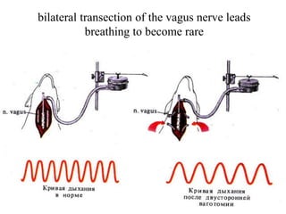 bilateral transection of the vagus nerve leads
breathing to become rare
 
