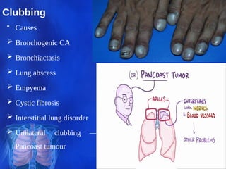 Respiratory system analysis & Diagnosis Assessment.pdf