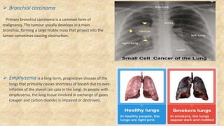  Bronchial carcinoma
Primary bronchial carcinoma is a common form of
malignancy. The tumour usually develops in a main
bronchus, forming a large friable mass that project into the
lumen sometimes causing obstruction.
 Emphysema is a long-term, progressive disease of the
lungs that primarily causes shortness of breath due to over-
inflation of the alveoli (air sacs in the lung). In people with
emphysema, the lung tissue involved in exchange of gases
(oxygen and carbon dioxide) is impaired or destroyed.
 