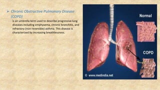  Chronic Obstructive Pulmonary Disease
(COPD)
is an umbrella term used to describe progressive lung
diseases including emphysema, chronic bronchitis, and
refractory (non-reversible) asthma. This disease is
characterized by increasing breathlessness.
 