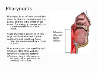 Respiratory system diseases | PPTX