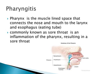  Pharynx is the muscle lined space that
connects the nose and mouth to the larynx
and esophagus (eating tube)
 commonly known as sore throat is an
inflammation of the pharynx, resulting in a
sore throat
 
