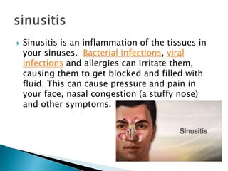  Sinusitis is an inflammation of the tissues in
your sinuses. Bacterial infections, viral
infections and allergies can irritate them,
causing them to get blocked and filled with
fluid. This can cause pressure and pain in
your face, nasal congestion (a stuffy nose)
and other symptoms.
 