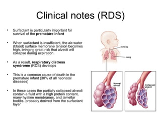 Infant Rds RESPIRATORY SYSTEM EMBRYOLOGY Final bit.ppt