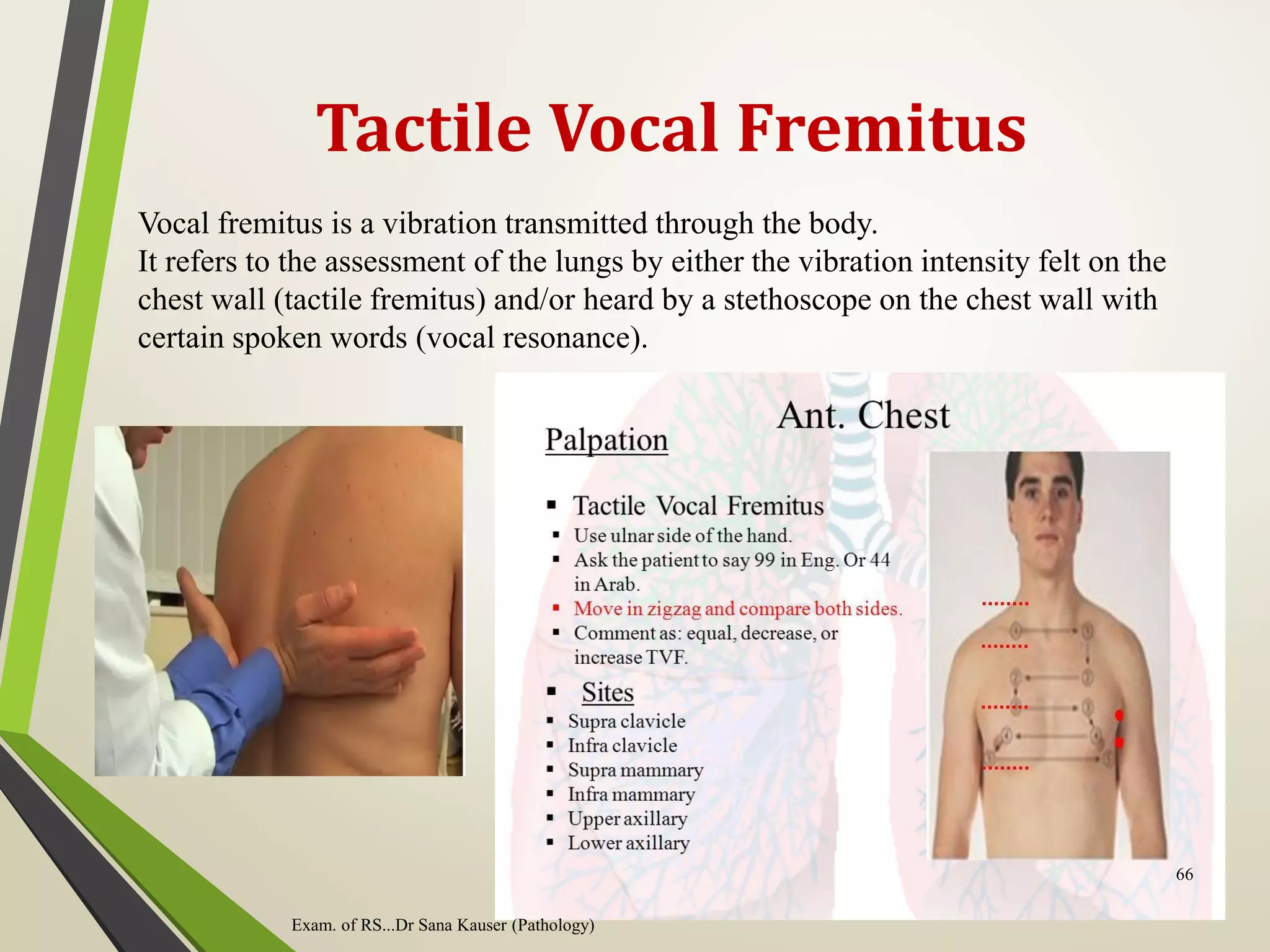 Tactile Vocal Fremitus
Vocal fremitus is a vibration transmitted through the body.
It refers to the assessment of the lungs by either the vibration intensity felt on the
chest wall (tactile fremitus) and/or heard by a stethoscope on the chest wall with
certain spoken words (vocal resonance).
Exam. of RS...Dr Sana Kauser (Pathology)
66
 