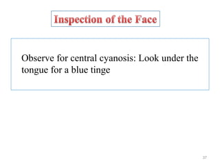 Observe for central cyanosis: Look under the
tongue for a blue tinge
37
 