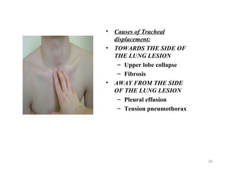• Causes of Tracheal
displacement:
• TOWARDS THE SIDE OF
THE LUNG LESION
– Upper lobe collapse
– Fibrosis
• AWAY FROM THE SIDE
OF THE LUNG LESION
– Pleural effusion
– Tension pneumothorax
39
 