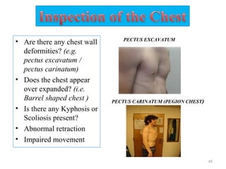 • Are there any chest wall
deformities? (e.g.
pectus excavatum /
pectus carinatum)
• Does the chest appear
over expanded? (i.e.
Barrel shaped chest )
• Is there any Kyphosis or
Scoliosis present?
• Abnormal retraction
• Impaired movement
45
PECTUS EXCAVATUM
PECTUS CARINATUM (PEGION CHEST)
 